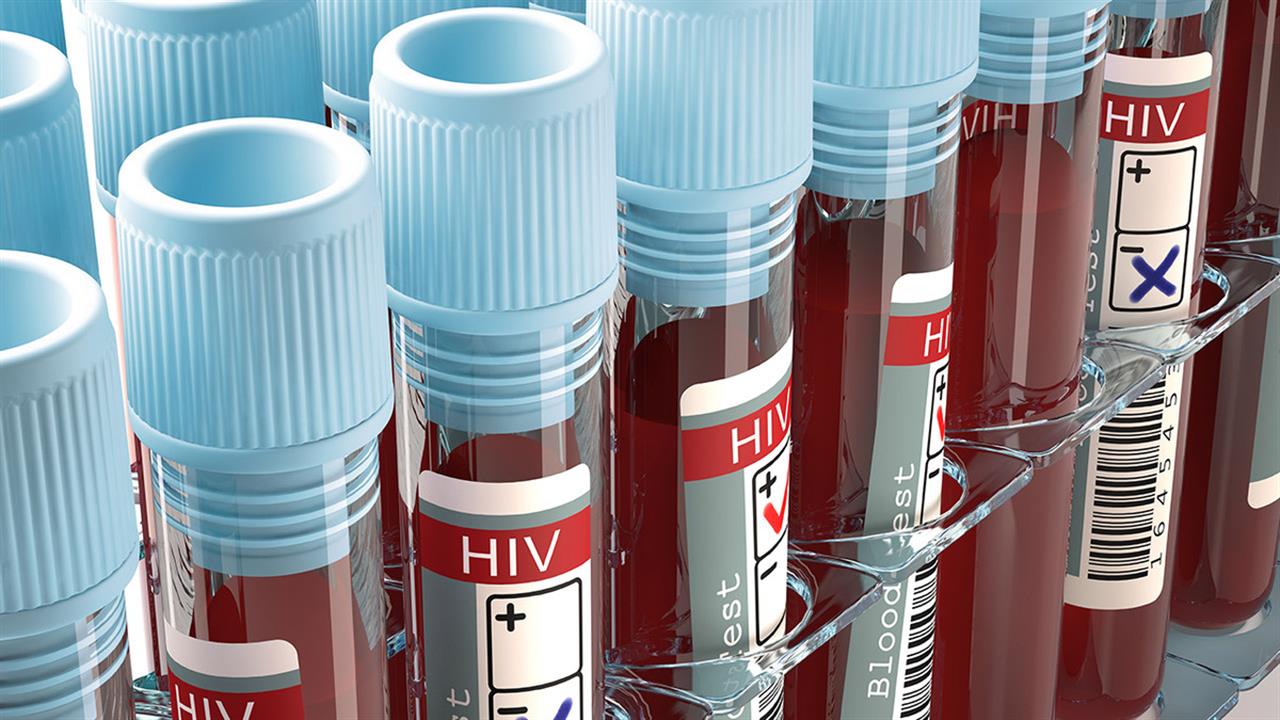 Εμφυτεύσιμη συσκευή νανο-υγρών χορηγεί πειραματικό φάρμακο κατά του HIV