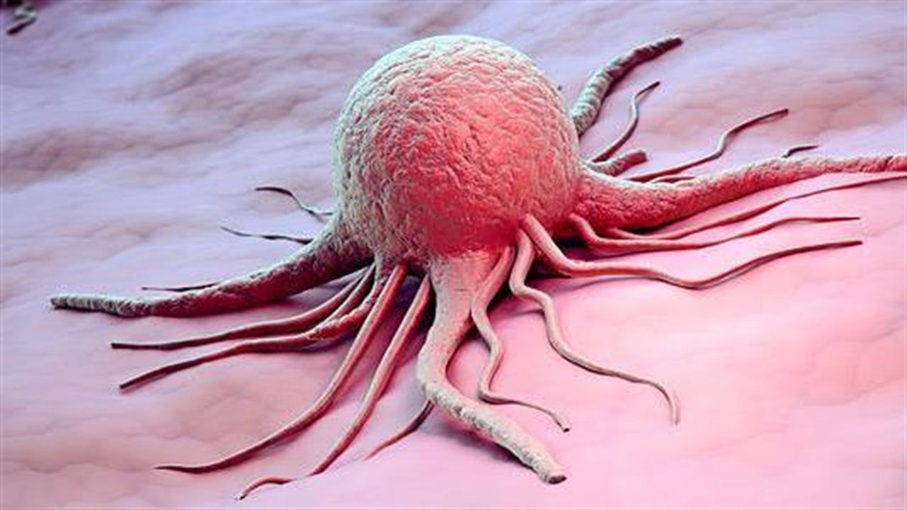 Καρκίνος: Νέα στοιχεία για το μηχανισμό μετάστασης