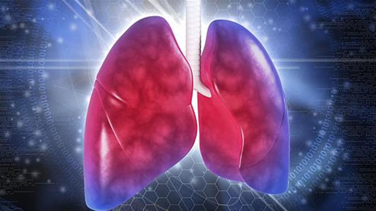 Εξέταση αναπνοής για τη διάγνωση του καρκίνου στον πνεύμονα