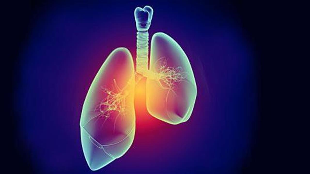 Σημαντικές εξελίξεις στον καρκίνο του πνεύμονα
