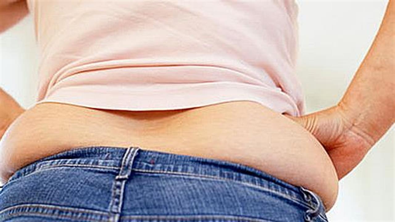Παχύσαρκος είναι 1 στους 5 Έλληνες
