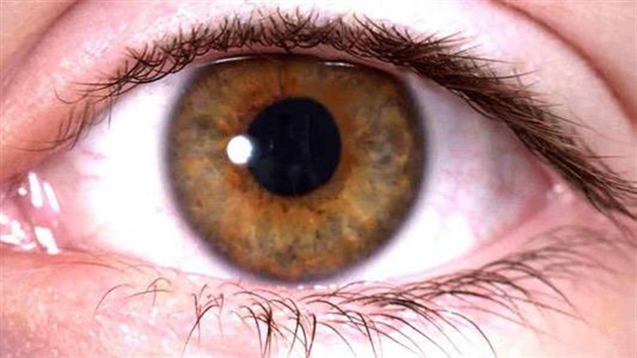 Υαλοειδοωχρική έλξη: Προλαμβάνοντας την μη αναστρέψιμη απώλεια όρασης