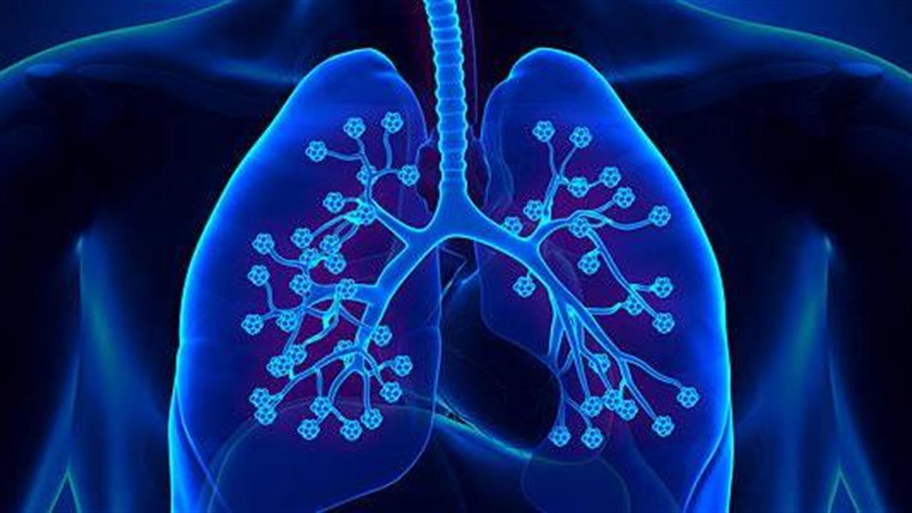 Το pembrolizumab επιμηκύνει το προσδόκιμο ζωής σε ασθενείς με μη μικροκυτταρικό καρκίνο του πνεύμονα
