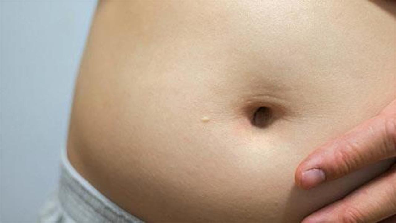 Τα παχύσαρκα παιδιά έχουν διαφορετικά εντερικά βακτήρια