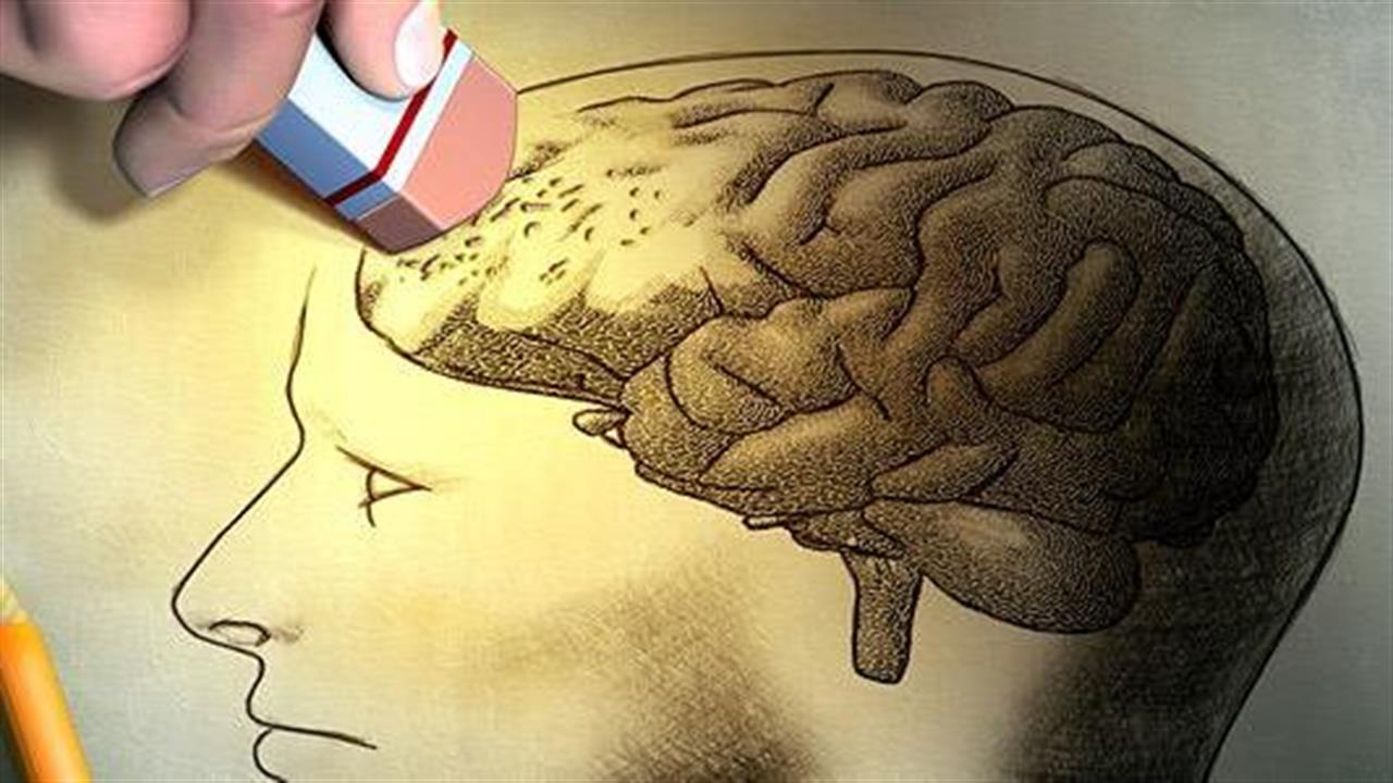Alzheimer: πρωτεΐνη θα μπορούσε να μειώσει την τοξικότητα του αμυλοειδούς