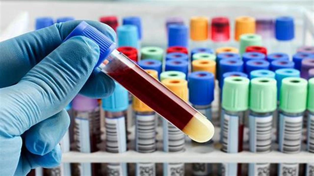 Βελτιώσεις από το υπουργείο Υγείας στη διάταξη για τα αιμοληπτήρια εκτός διαγνωστικών κέντρων
