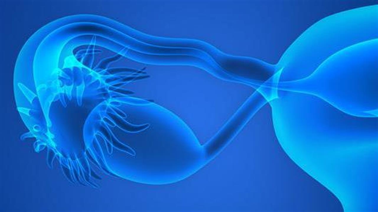 Εντοπίστηκαν 12 νέα γονίδια για τον καρκίνο των ωοθηκών