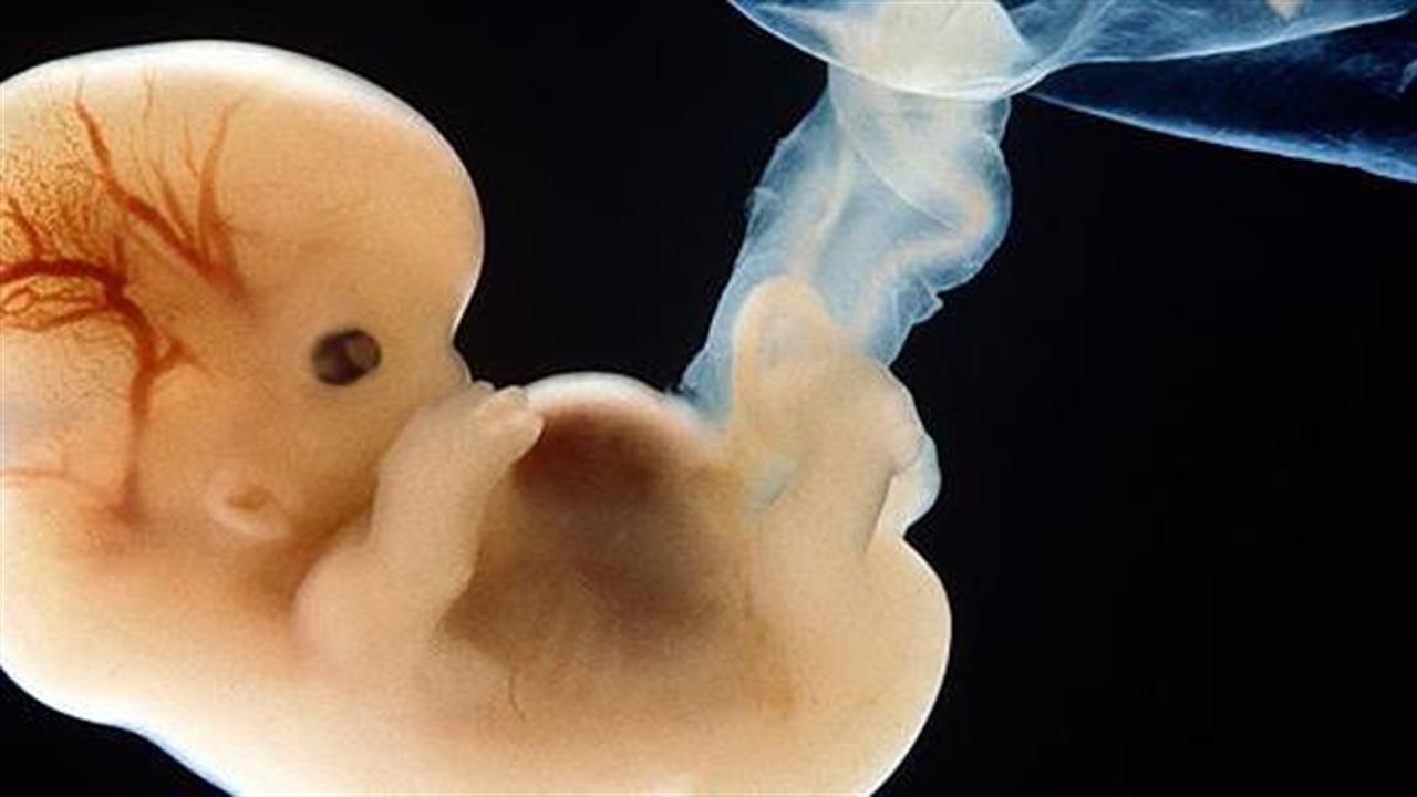 Κύηση: Τα πολλά λιπαρά και σάκχαρα επηρεάζουν την ανάπτυξη του εμβρύου