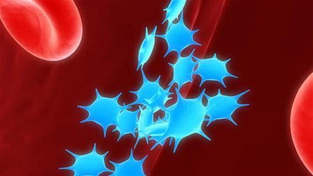 Τα αυξημένα επίπεδα αιμοπεταλίων μπορεί να ‘’δείχνουν’’ καρκίνο