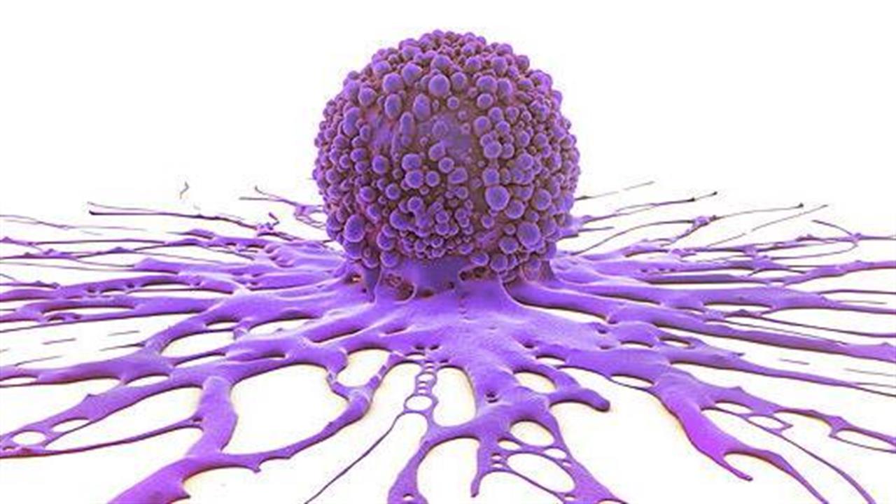 O αποφασιστικός ρόλος της ογκοθερμίας στην ανοσολογία του καρκίνου