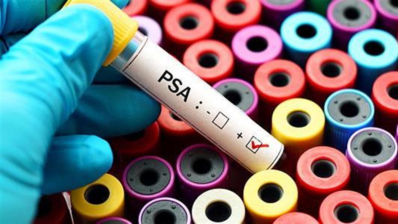 Η εξέταση PSA μειώνει τον κίνδυνο θανάτου από καρκίνο στον προστάτη