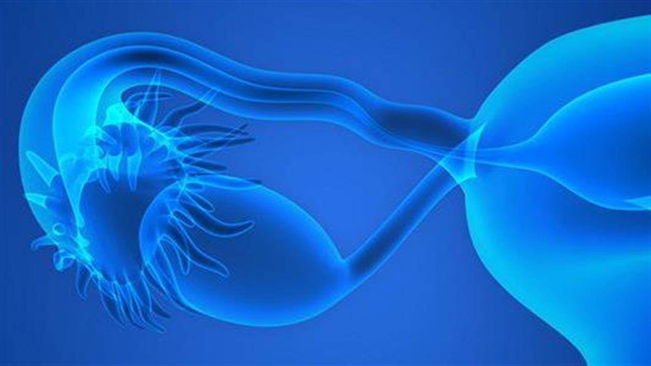 Τα χλαμύδια αυξάνουν τον κίνδυνο καρκίνου στις ωοθήκες