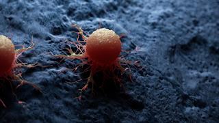 Ερευνητές συνέταξαν λεπτομερή κατάλογο βακτηρίων που ζουν στις καρκινικές μεταστάσεις