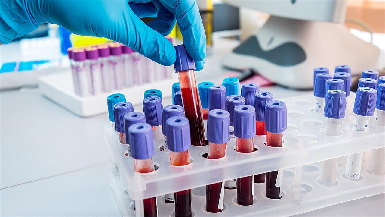 Έρευνα: Η ομάδα αίματος δεν παίζει ρόλο στον κίνδυνο νόσησης από covid-19
