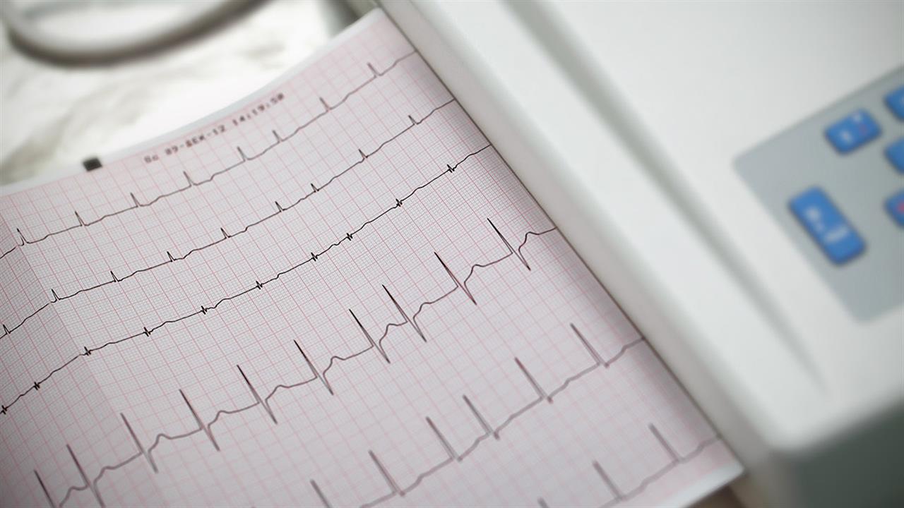Ωνάσειο Καρδιοχειρουργικό Κέντρο: Επιτυχημένη διεξαγωγή 9 περιστατικών κρυοκατάλυσης κολπικής μαρμαρυγής σε μία ημέρα