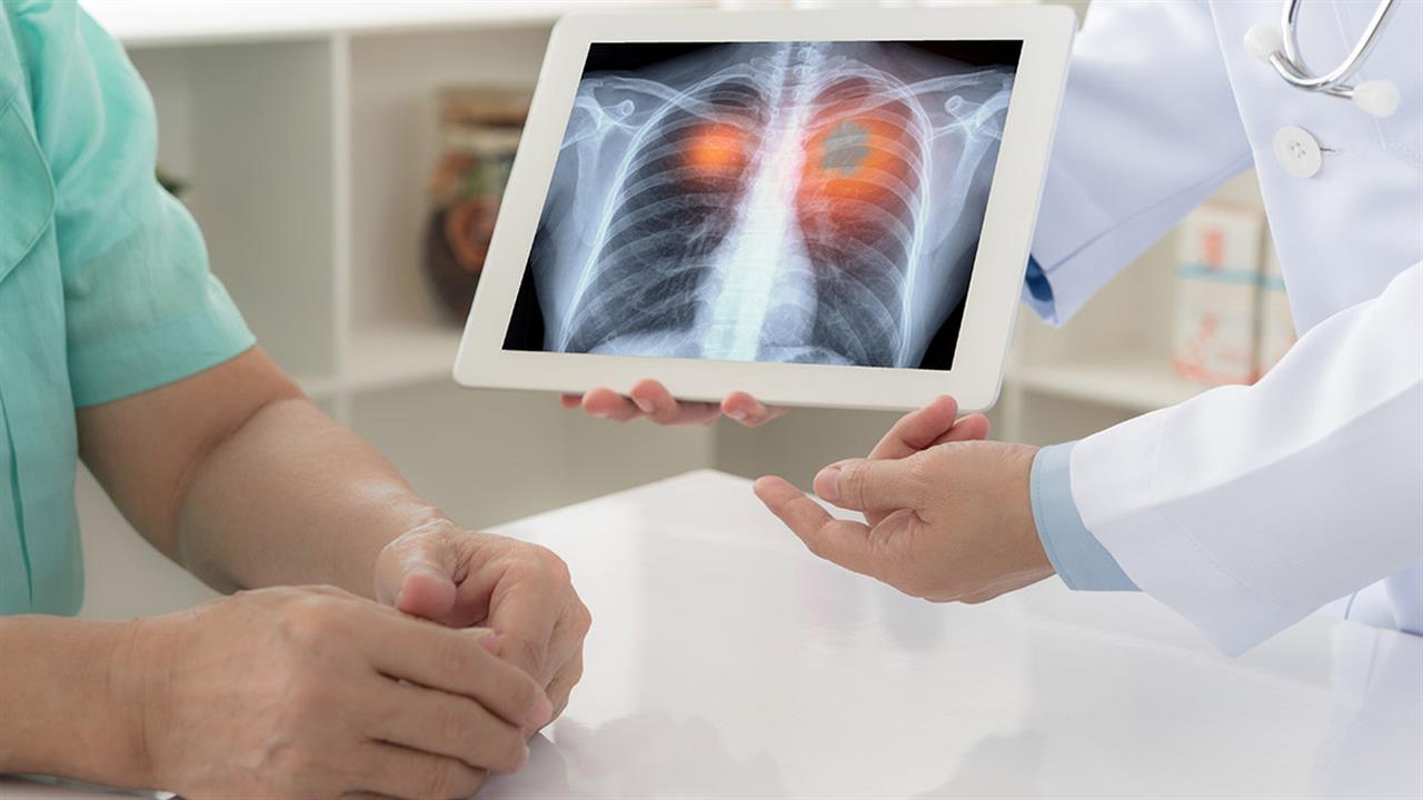 Μελέτη: Ασθενείς με καρκίνο στον πνεύμονα ανταποκρίνονται καλά σε εμβόλια κατά της COVID-19