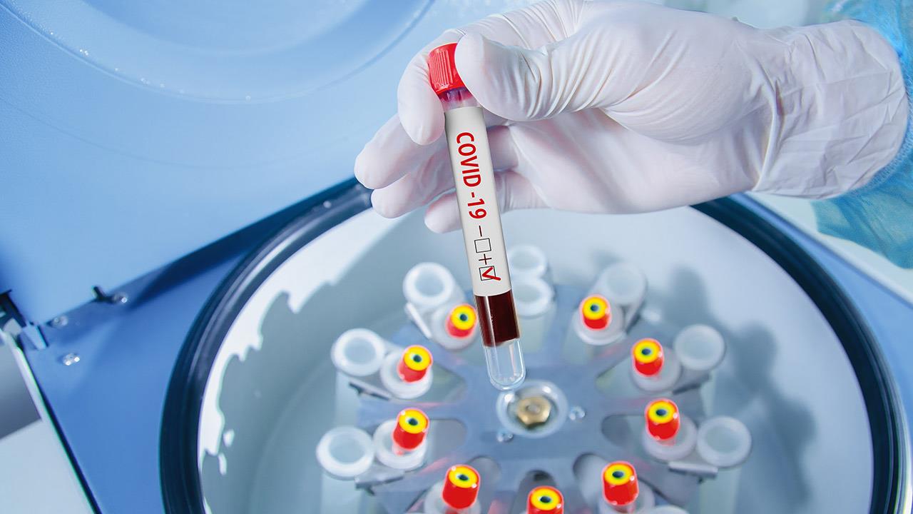 Εντοπίστηκε νέα μετάλλαξη σαν Ομικρον - Ξεγλιστρά του PCR τεστ