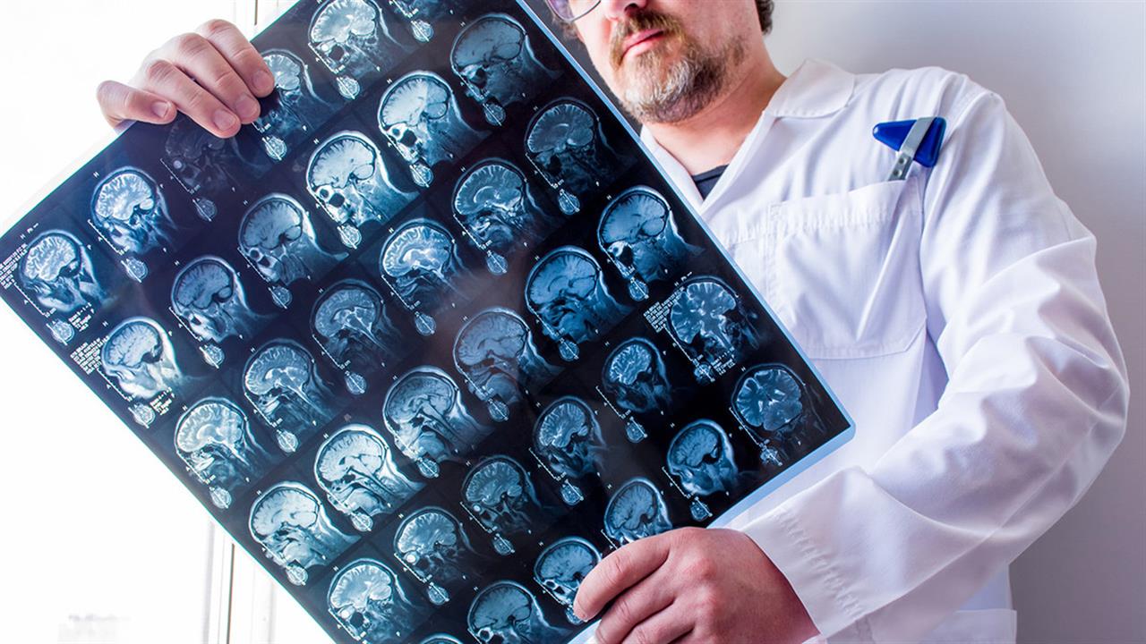 Άνθρωποι με νευρική ανορεξία έχουν μικρότερο εγκέφαλο