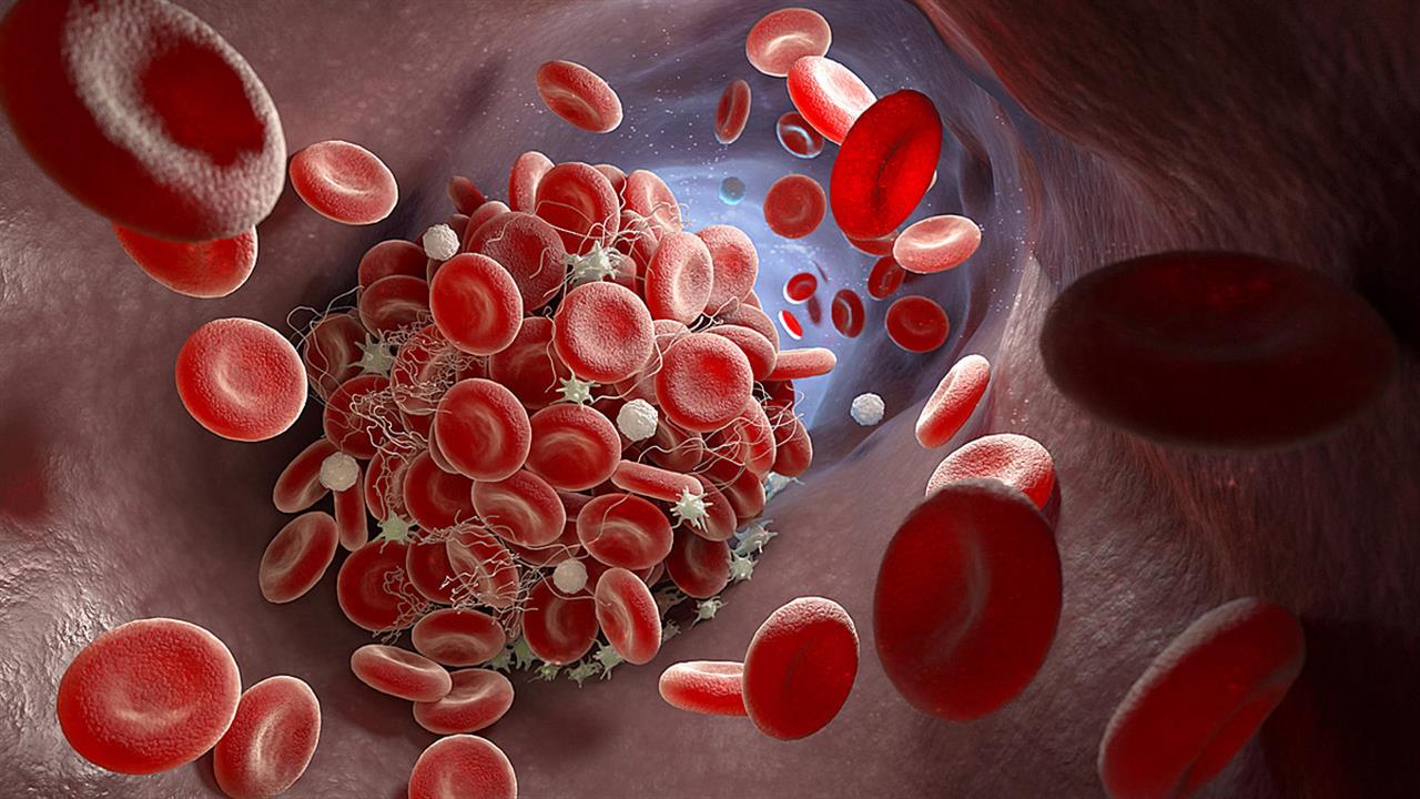 Χαμηλά αιμοπετάλια: Συνήθη αίτια θρομβοπενίας