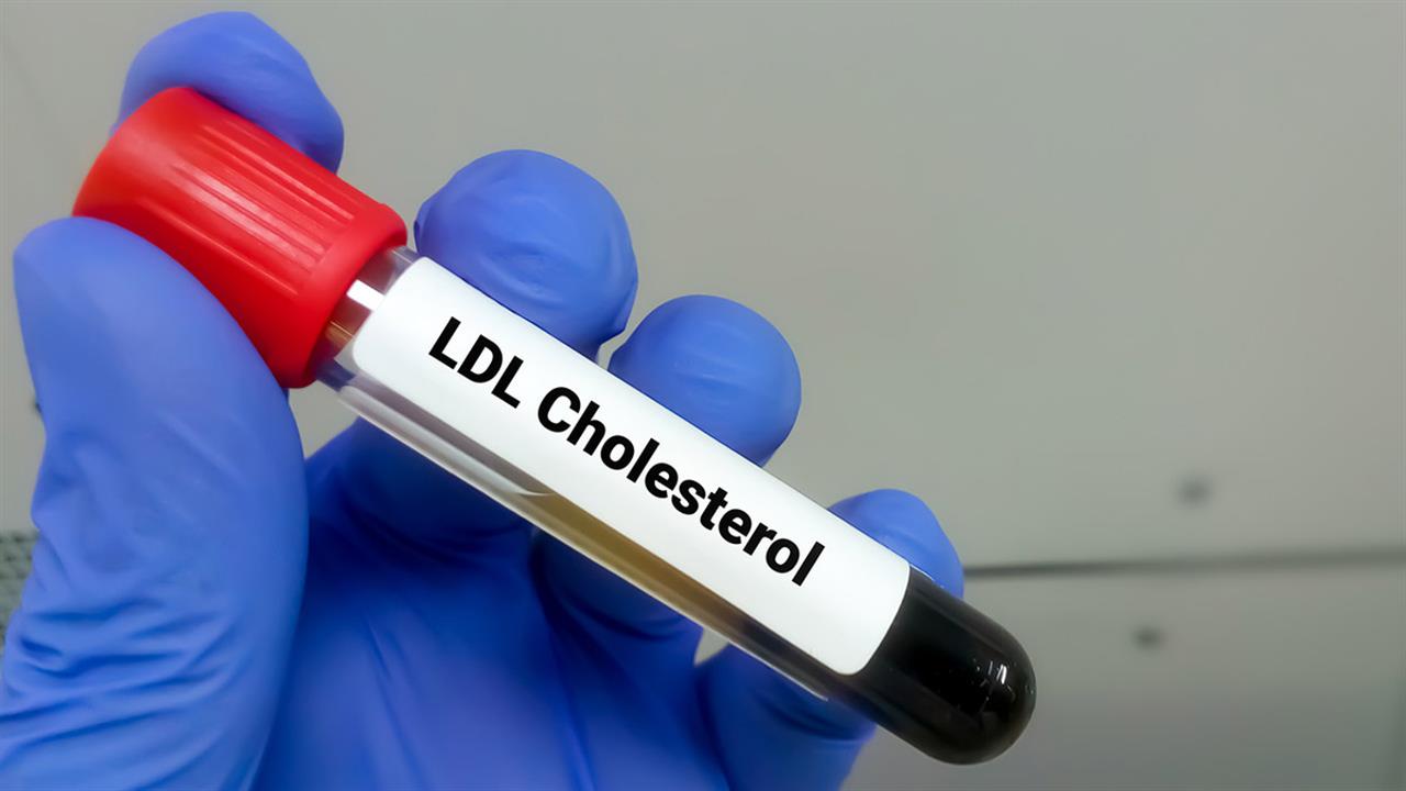 Υπέρταση και υψηλή χοληστερόλη LDL πριν τα 55 αυξάνουν τον κίνδυνο καρδιακής νόσου ακόμα και αν βελτιωθούν [μελέτη]