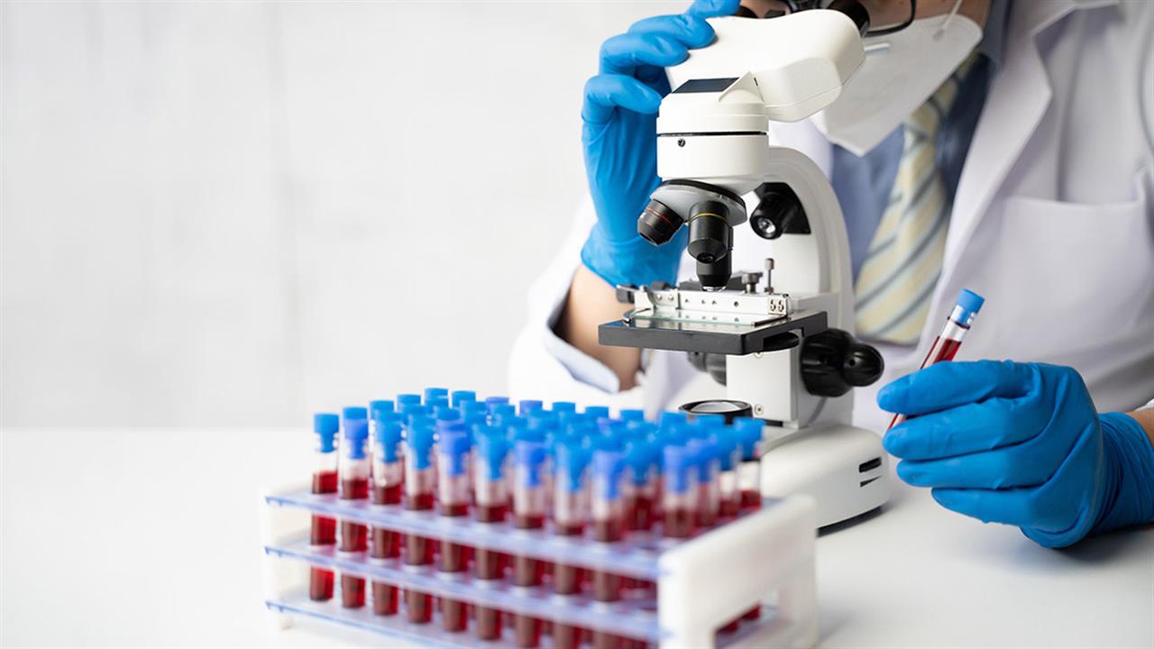 Νέα εξέταση αίματος εντοπίζει 18 είδη καρκίνου στα αρχικά τους στάδια [μελέτη]
