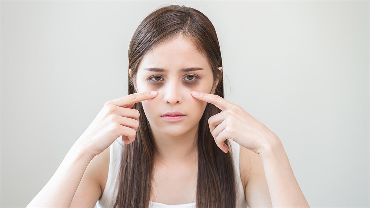 Μαύροι κύκλοι: Γιατί εμφανίζονται και πώς θεραπεύονται