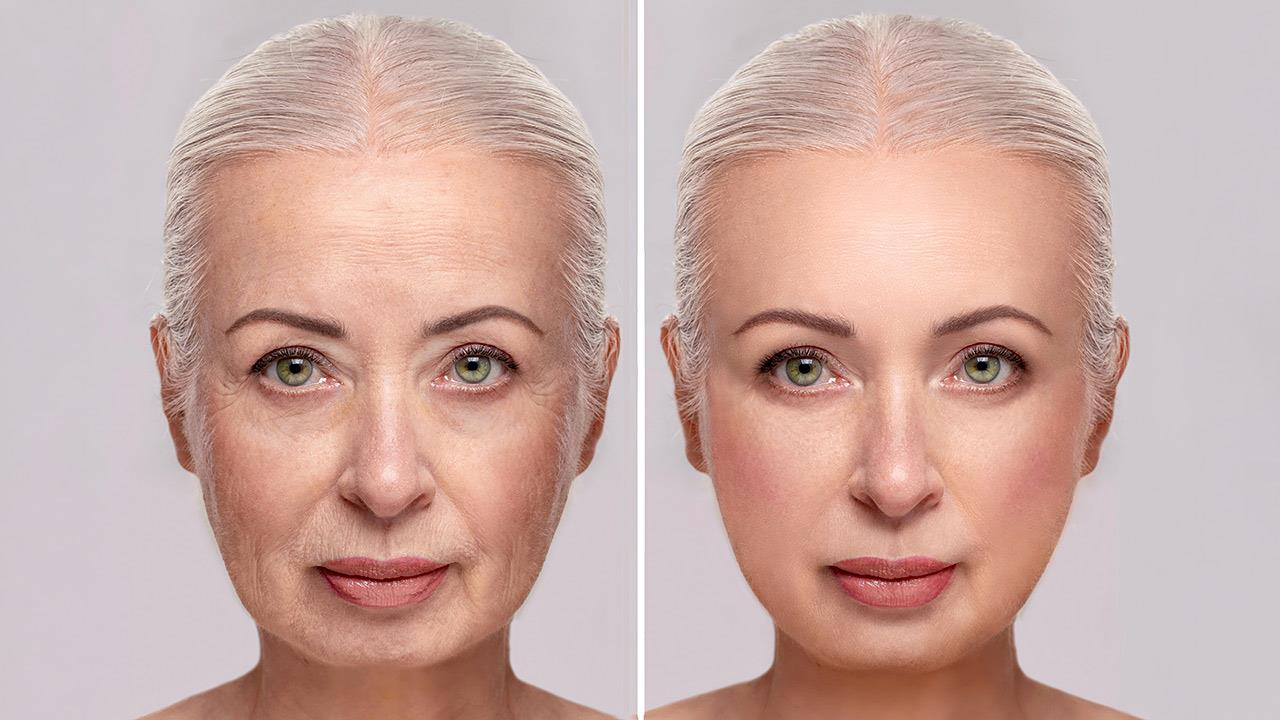 Δέρμα: Πώς επιτυγχάνεται η βελτίωση της ποιότητάς του