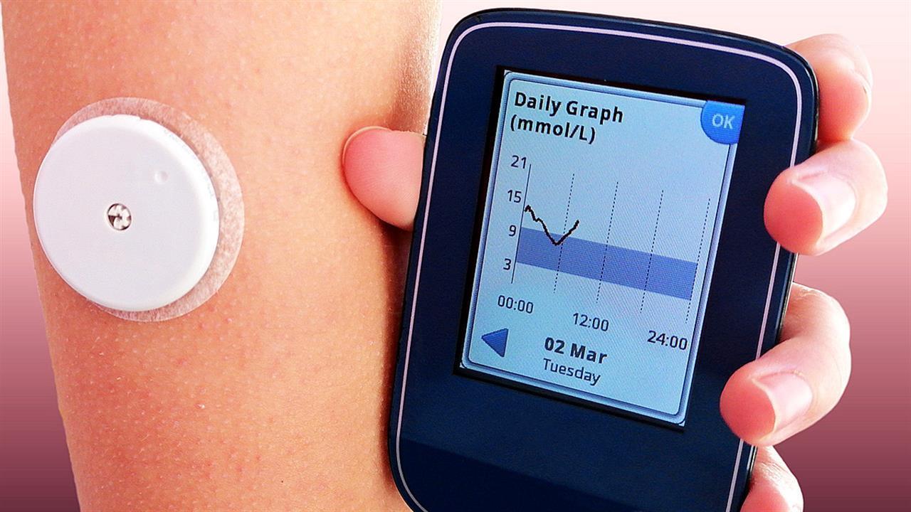40.000 άτομα με διαβήτη στερούνται τα συστήματα συνεχούς καταγραφής γλυκόζης (CGM)