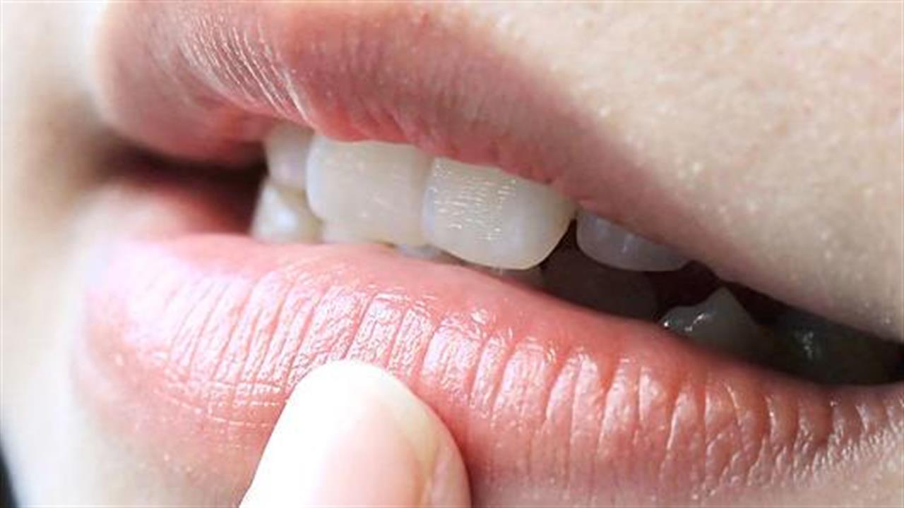 Άφθες στο στόμα: Αιτίες και θεραπεία