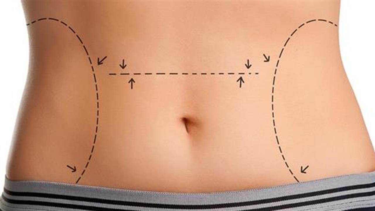 απώλεια βάρους στην επούλωση λίπους στην κοιλιά