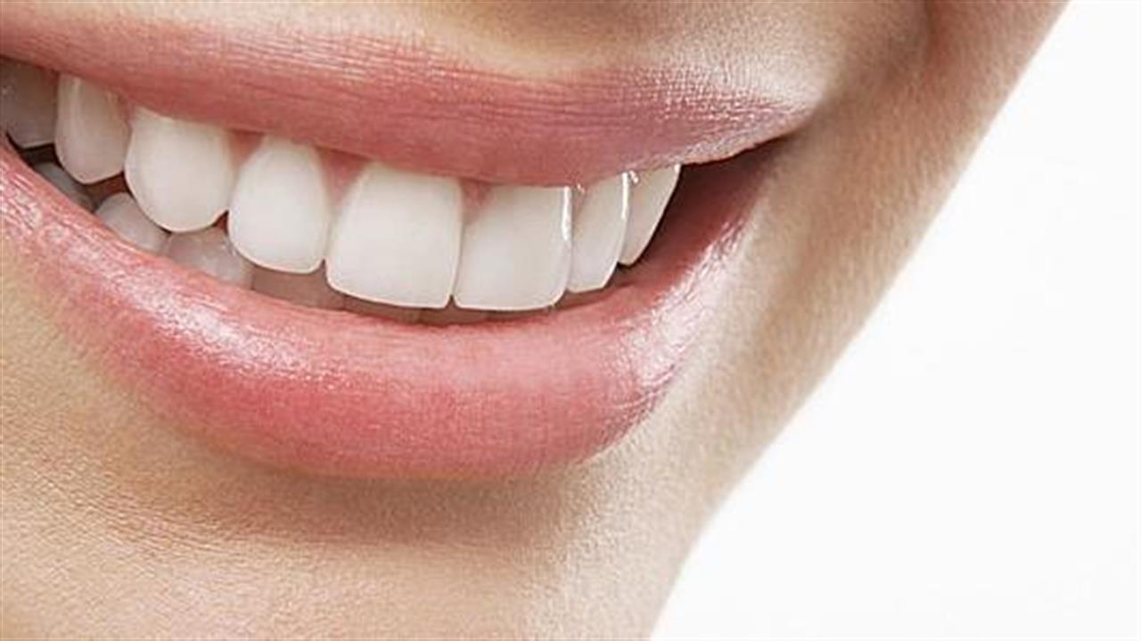 Λεύκανση δοντιών: Mόδα ή ανάγκη;