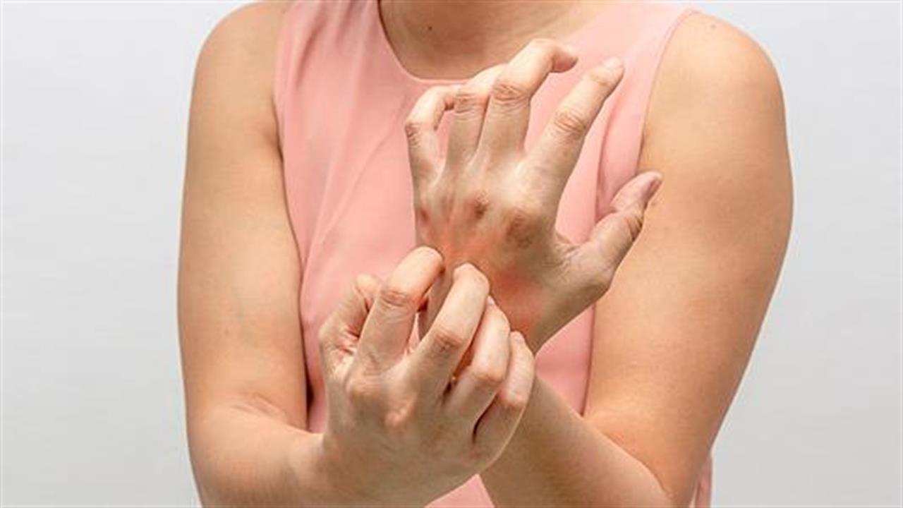 Δερματικές αλλεργίες την άνοιξη: Είδη και προφυλάξεις