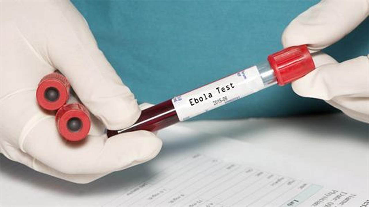 Επιστήμονες ανακάλυψαν την Αχίλλειο πτέρνα του ιού Έμπολα