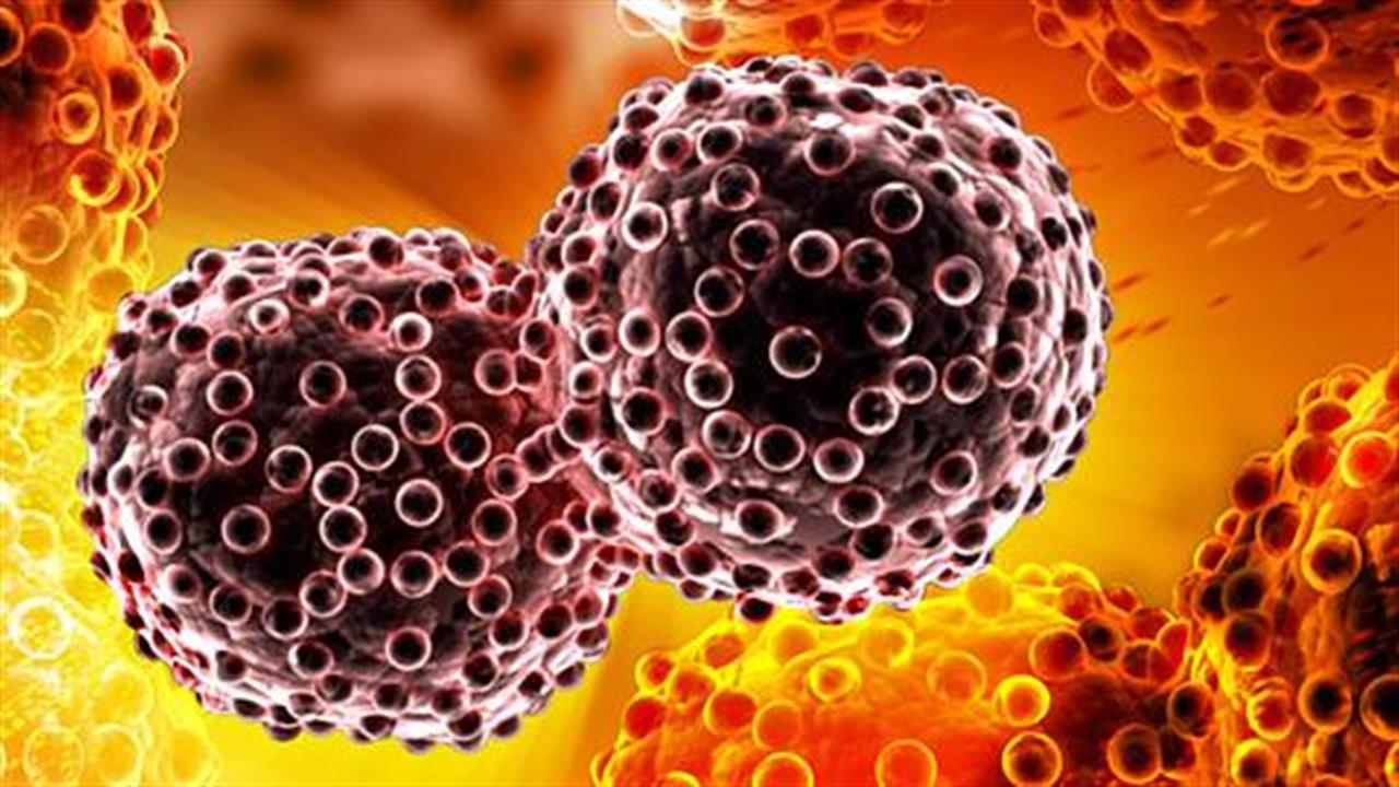 Μικροκυτταρικός καρκίνος του πνεύμονα: έκπτωση περισσότερων καταστολέων όγκων