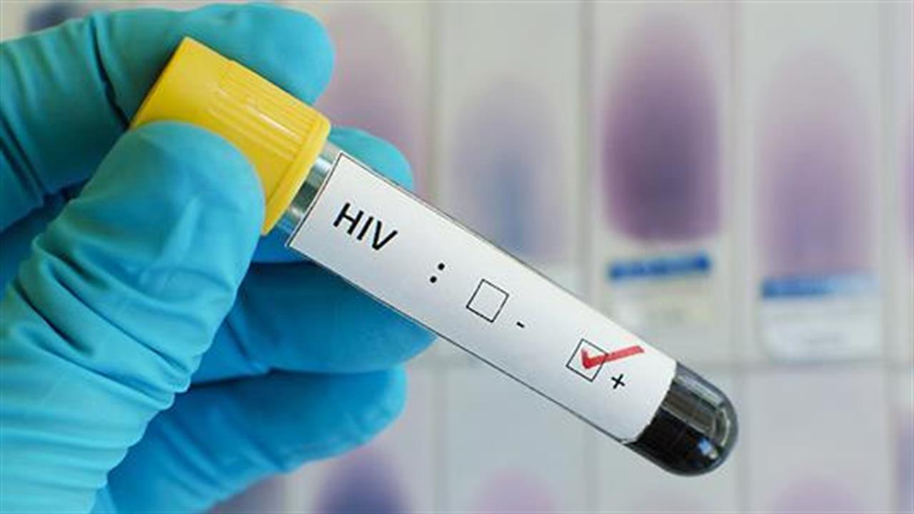 Ποια είναι τα αρχικά συμπτώματα της λοίμωξης από τον ιό HIV