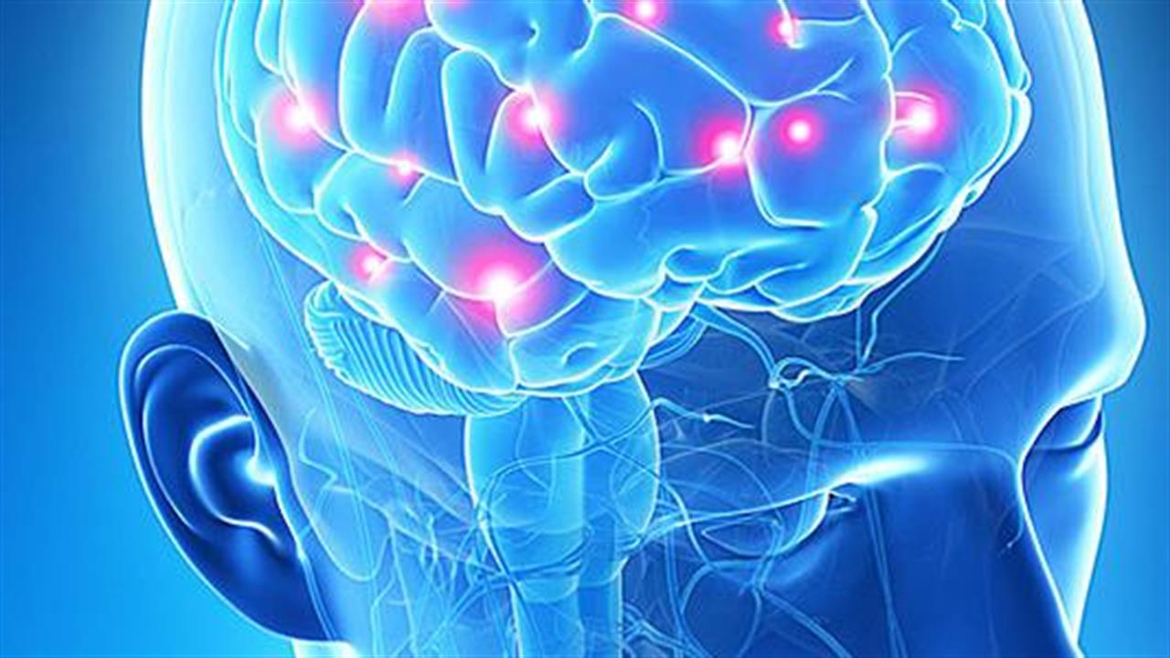Εγκεφαλοαγγειακά νοσήματα συνδέονται με την ψύχωση σε ασθενείς με Alzheimer