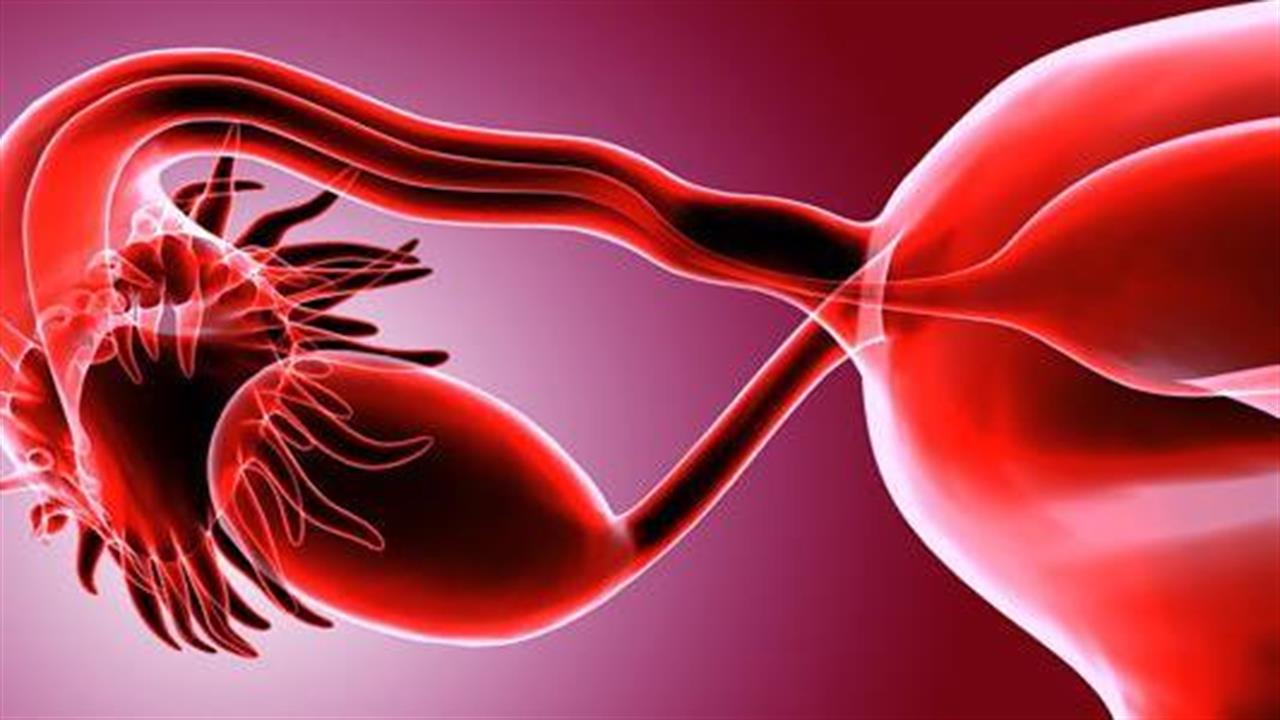 Έρευνα: Ο καρκίνος των ωοθηκών ξεκινά από τις σάλπιγγες