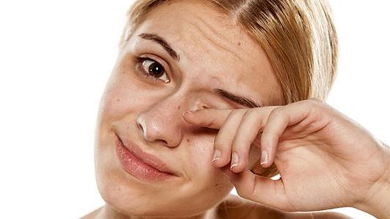 Подергивающийся глаз. Нервный тик симптомы. Подёргивания века в уголках глаз. Нервный тик в глазах людей. Нервный тик.