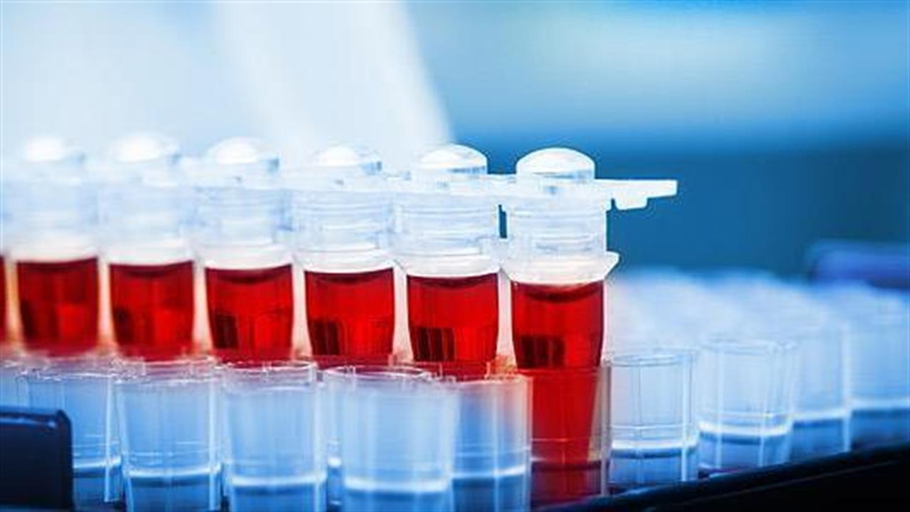 Νέα εξέταση αίματος ανιχνεύει 50 τύπους καρκίνου