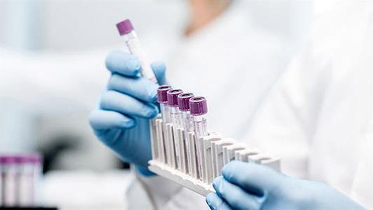 ESET Foundation: Xρηματοδοτεί την ανάπτυξη των πρώτων 100.000 διαγνωστικών PCR τεστ για  Covid-19 από εταιρείες της Σλοβακίας