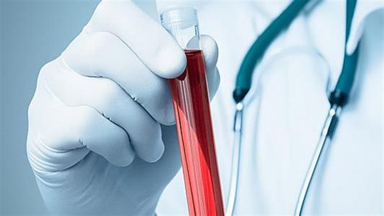 Εξέταση αίματος θα συμβάλλει στην πρόβλεψη της πορείας ασθενών  με covid-19