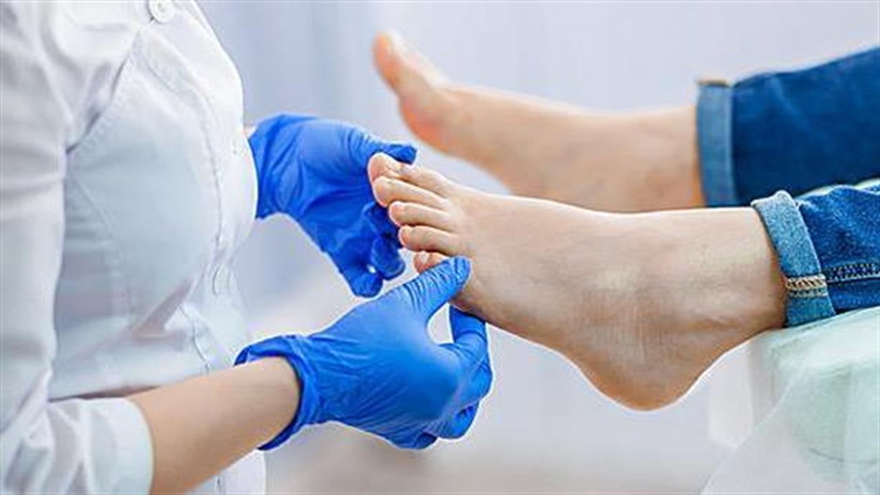 Διαβητικό πόδι: H έγκαιρη διάγνωση αποτελεί τον ακρογωνιαίο λίθο στη θεραπεία