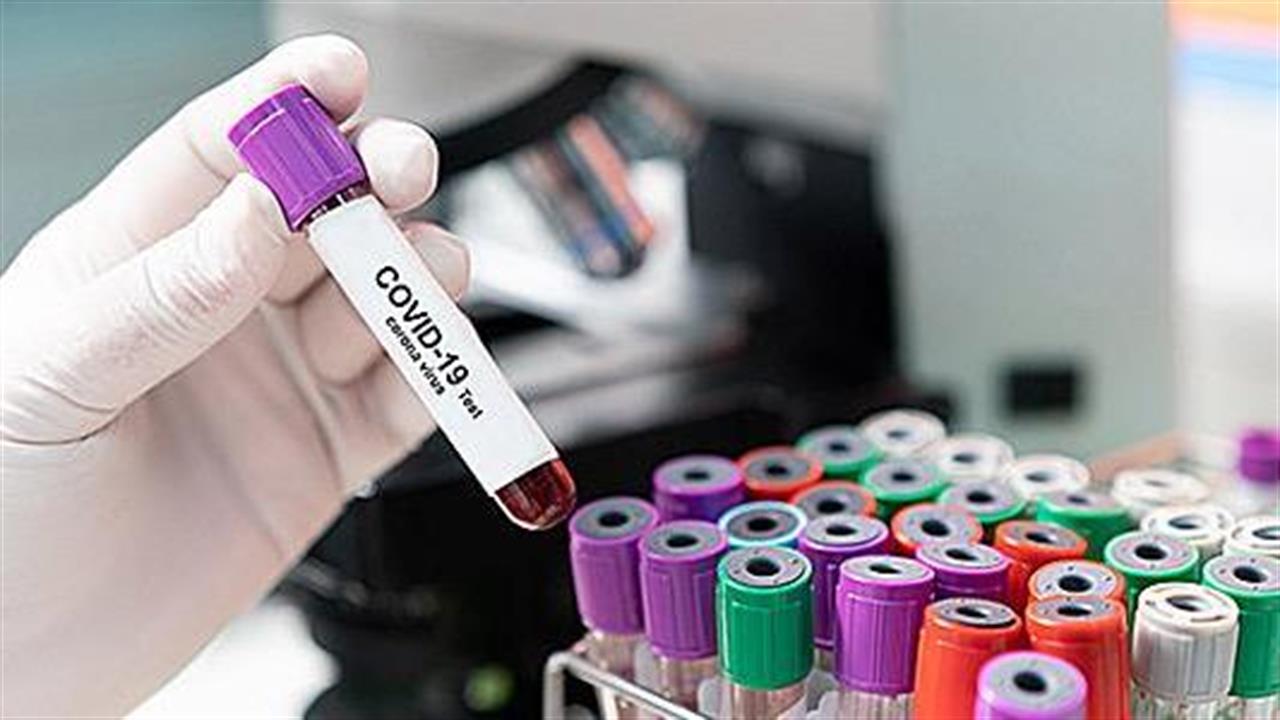 Κορωνοϊός: Ποια είναι τα χαρακτηριστικά του τεστ PCR και της ταχείας ανίχνευσης αντιγόνου