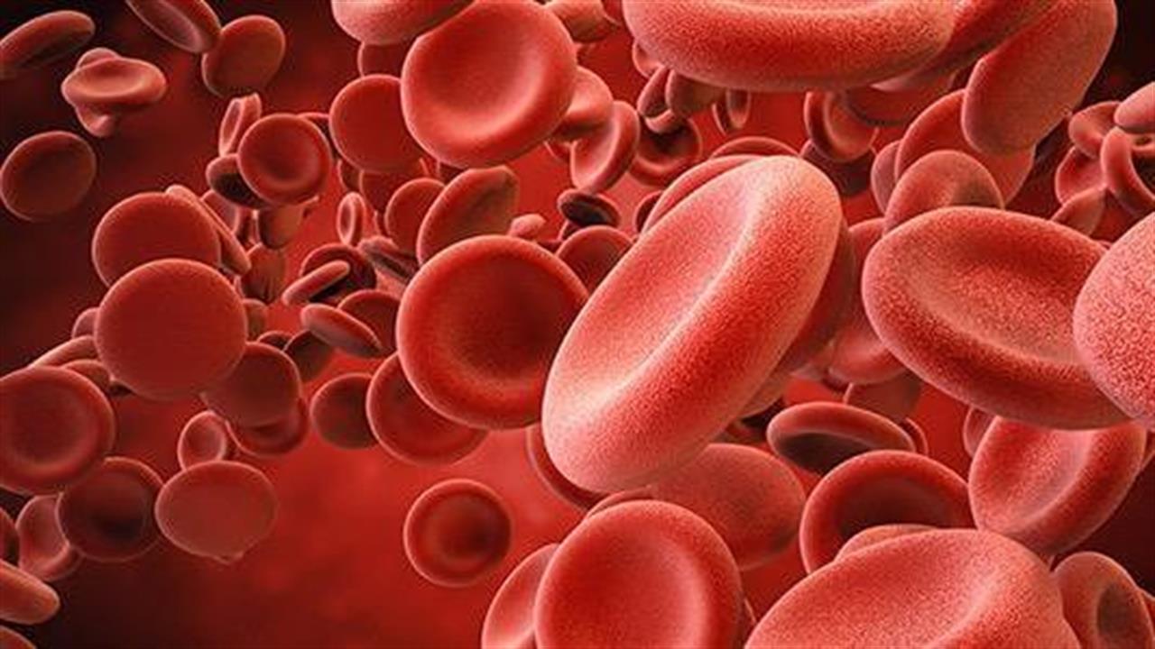 Τα μυελικά κατασταλτικά κύτταρα στο αίμα συνδέονται με σοβαρή νόσηση από COVID-19