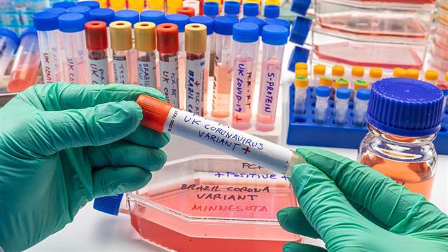 Εντοπίστηκε σε περιοχή της Γαλλίας παραλλαγή του Sars-cov2 που μπορεί να μην εντοπίζεται από το τεστ RT-PCR