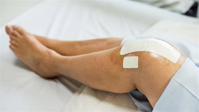 Ανακάλυψη στην αναγέννηση του δέρματος θα μπορούσε να σηματοδοτήσει τεράστια πρόοδο στην πλαστική χειρουργική