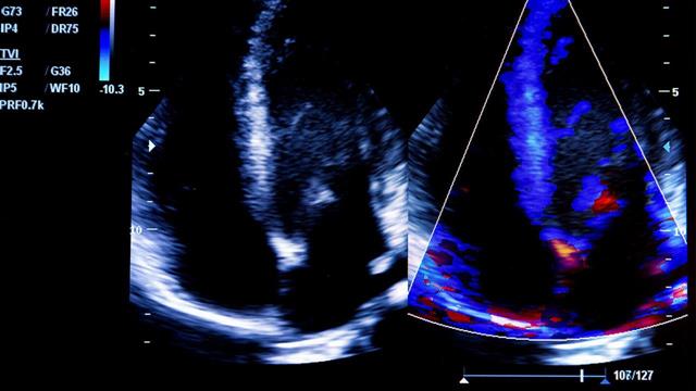 Δωρεά καρδιολογικού υπερηχογράφου από τη Euromedica στο Γενικό Νοσοκομείο Κέντρο Υγείας Καλύμνου