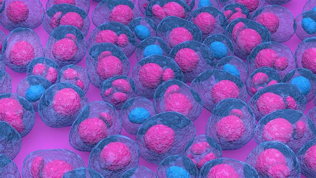 Τα περιστατικά μυελώματος έχουν υπερδιπλασιαστεί από το 1990