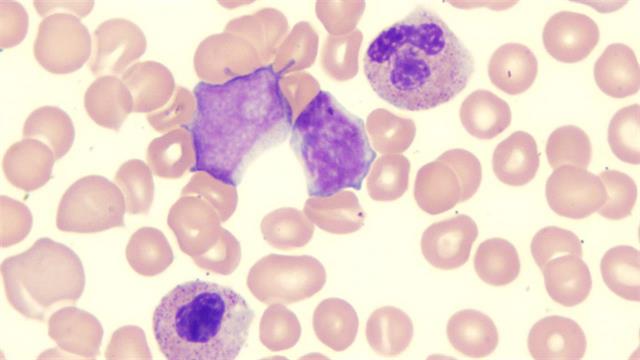 Η Novartis λαμβάνει από τον FDA χαρακτηρισμό διαδικασίας ταχείας αξιολόγησης για το sabatolimab