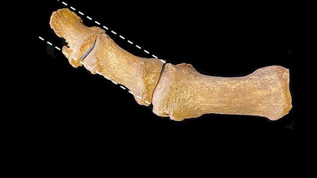 Κότσια προκάλεσε και στον Μεσαίωνα η μόδα στα παπούτσια